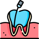 022-root canal