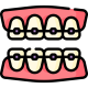 023-braces